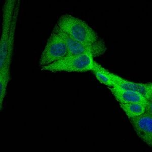 Molecular & Cancer Biology
