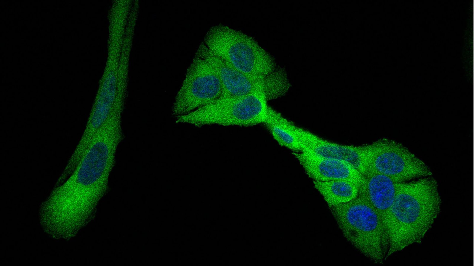 Molecular & Cancer Biology